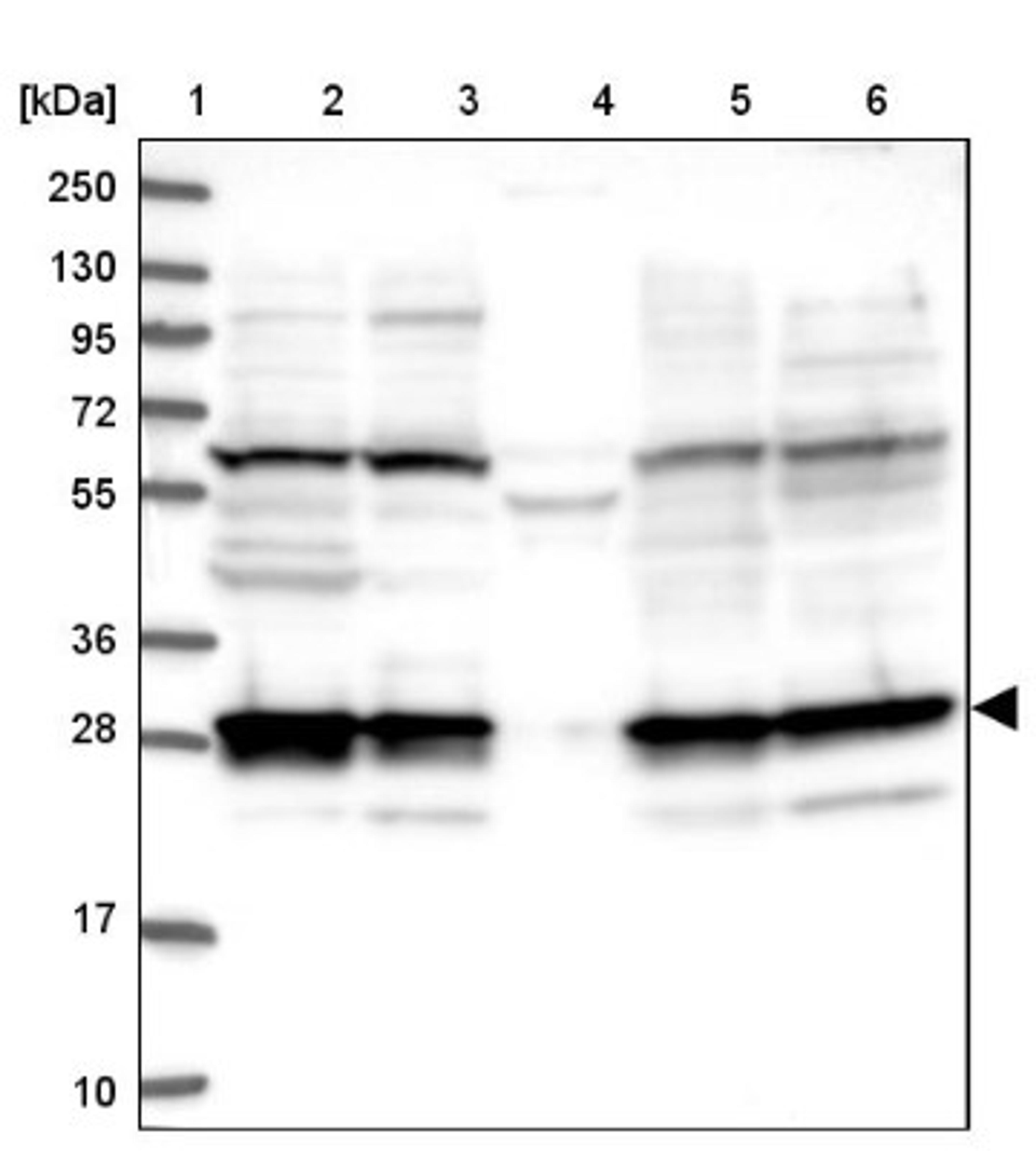 Western Blot: 26S proteasome subunit 9 Antibody [NBP2-47561] - Lane 1: Marker [kDa] 250, 130, 95, 72, 55, 36, 28, 17, 10.  Lane 2: Human cell line RT-4.  Lane 3: Human cell line U-251MG.  Lane 4: Human plasma (IgG/HSA depleted).  Lane 5: Human liver tissue.  Lane 6: Human tonsil tissue.