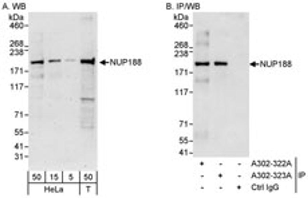 Detection of human NUP188 by western blot and immunoprecipitation.