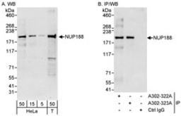 Detection of human NUP188 by western blot and immunoprecipitation.