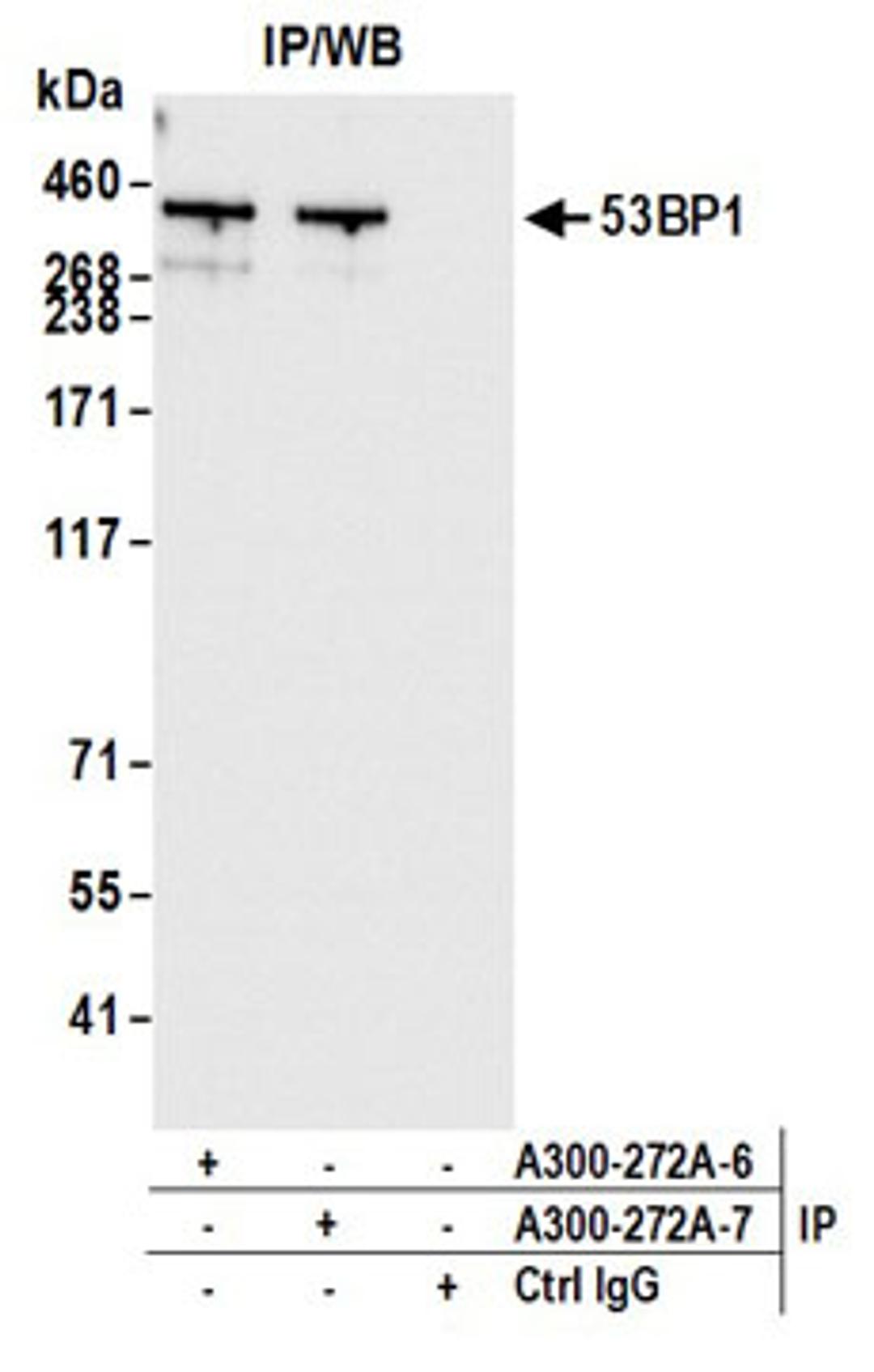 Detection of human 53BP1 by western blot of immunoprecipitates.