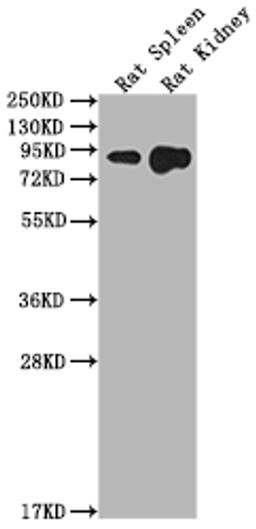 Western Blot. Positive WB detected in: Rat Spleen tissue, Rat Kidney tissue. All lanes: Ace2 antibody at 1:2000. Secondary. Goat polyclonal to rabbit IgG at 1/50000 dilution. Predicted band size: 93 kDa. Observed band size: 93 kDa.