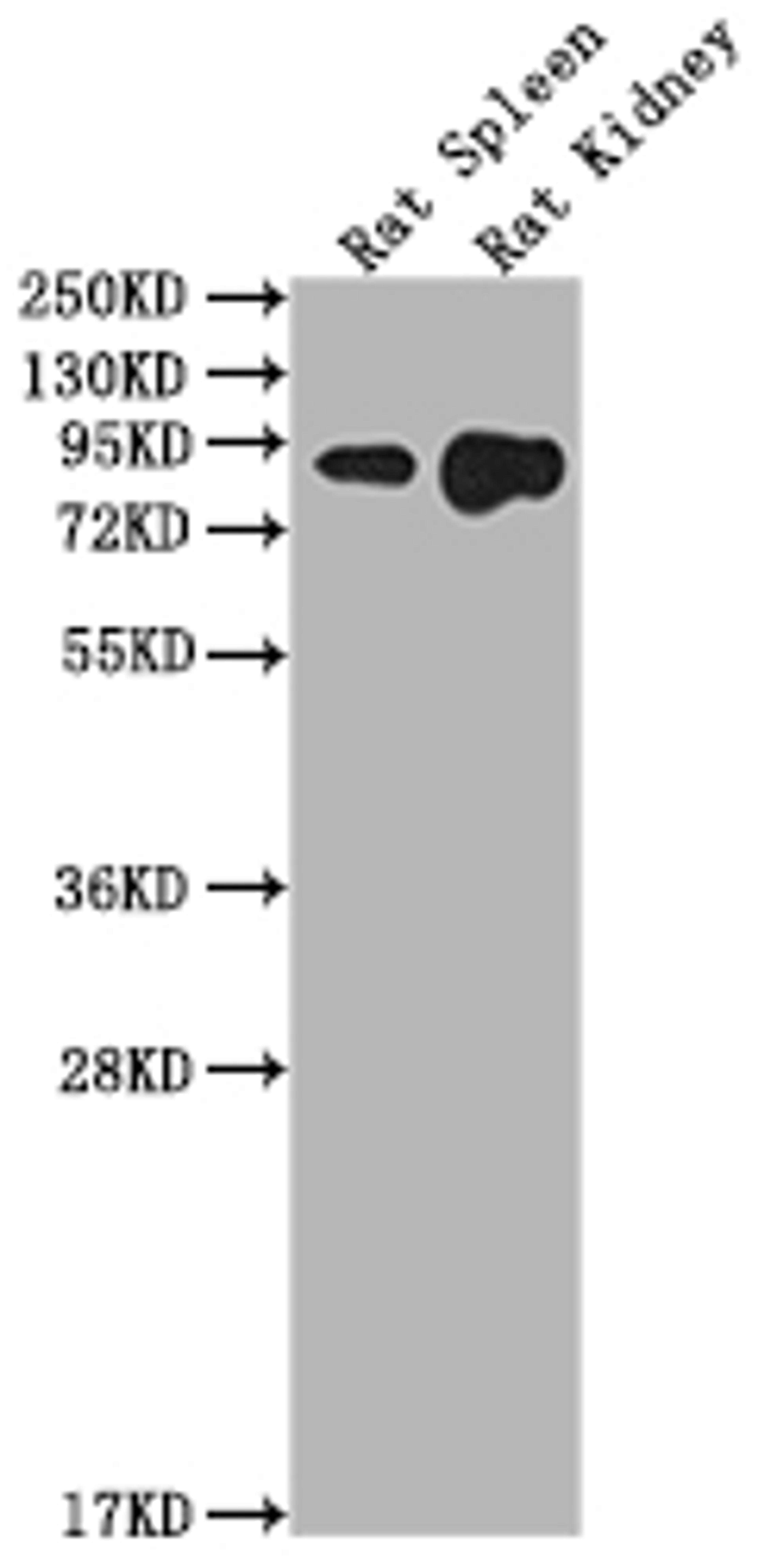 Western Blot. Positive WB detected in: Rat Spleen tissue, Rat Kidney tissue. All lanes: Ace2 antibody at 1:2000. Secondary. Goat polyclonal to rabbit IgG at 1/50000 dilution. Predicted band size: 93 kDa. Observed band size: 93 kDa.
