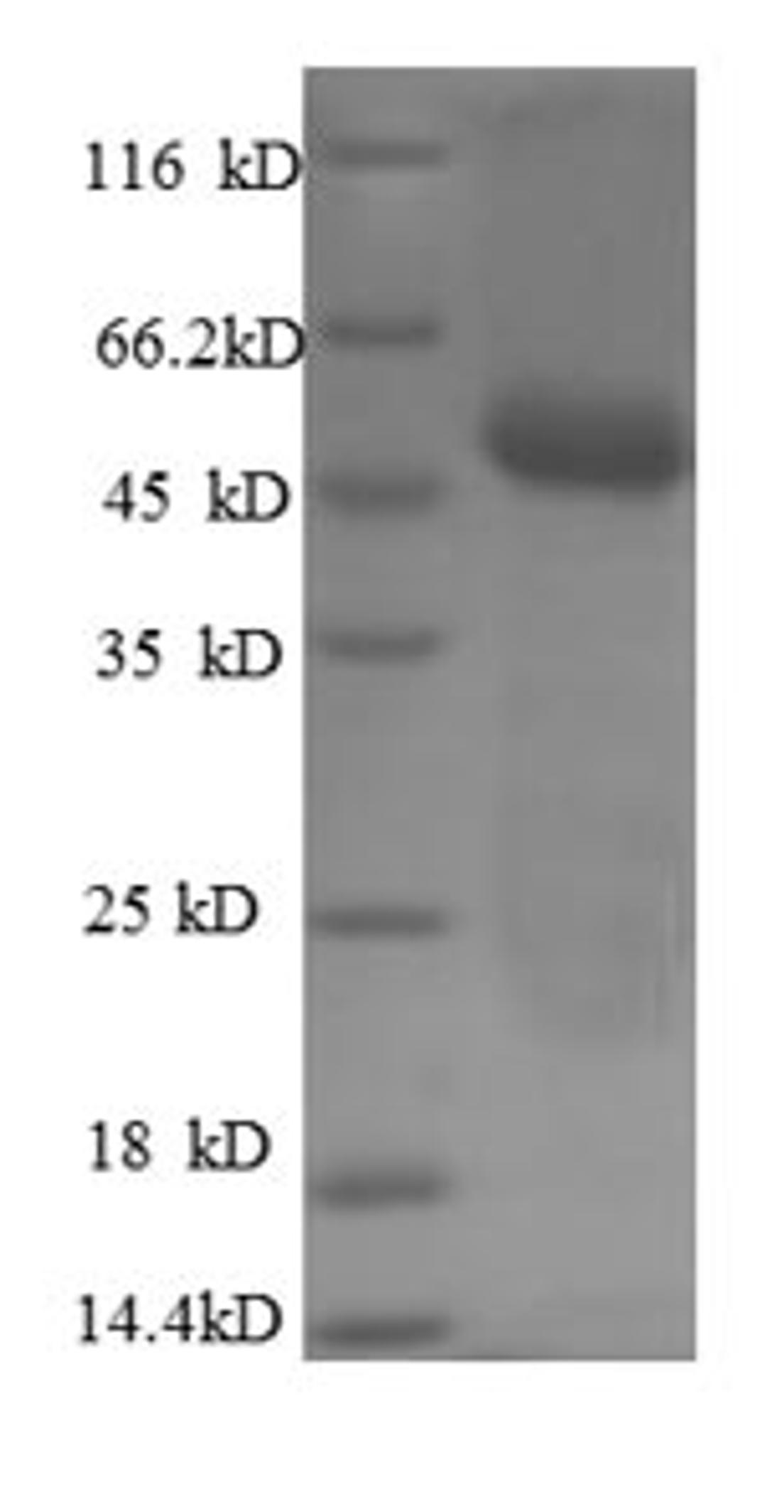 (Tris-Glycine gel) Discontinuous SDS-PAGE (reduced) with 5% enrichment gel and 15% separation gel.