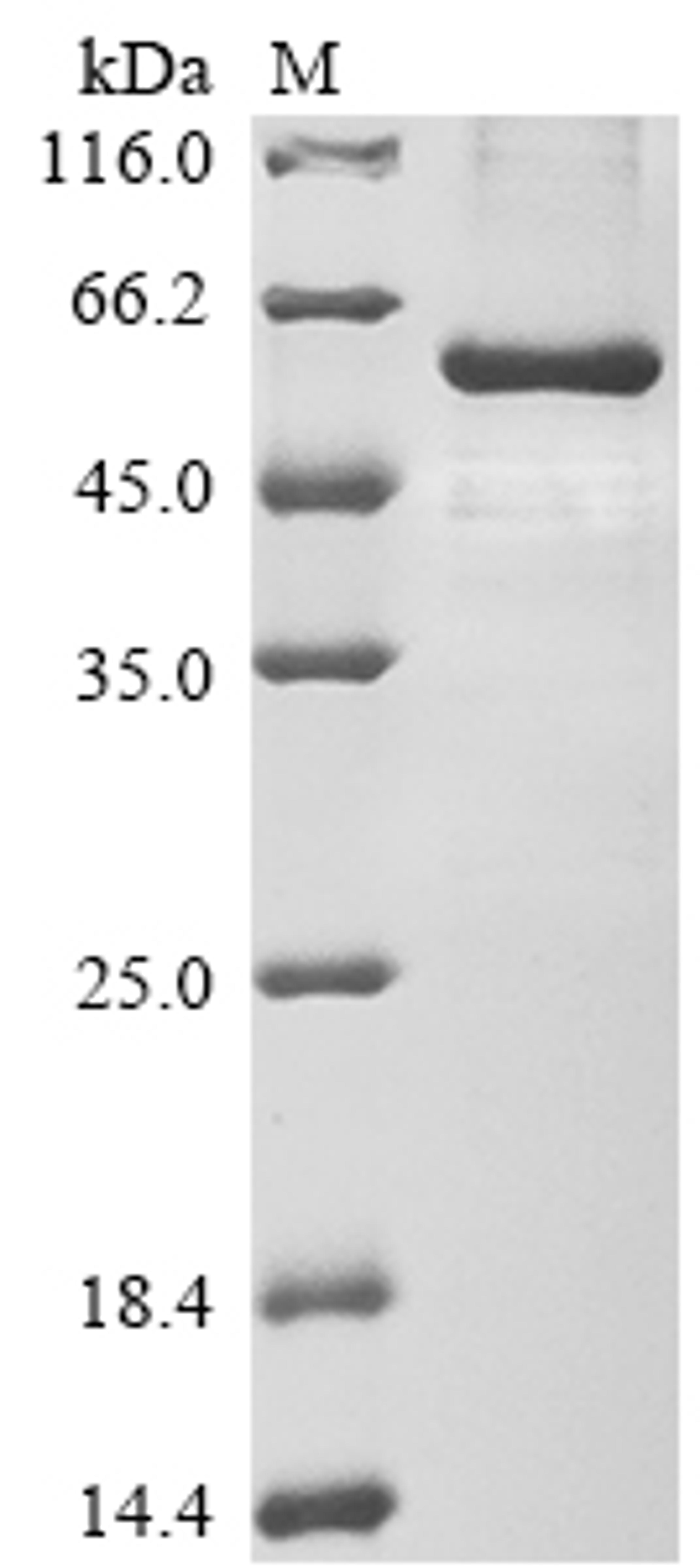 (Tris-Glycine gel) Discontinuous SDS-PAGE (reduced) with 5% enrichment gel and 15% separation gel.