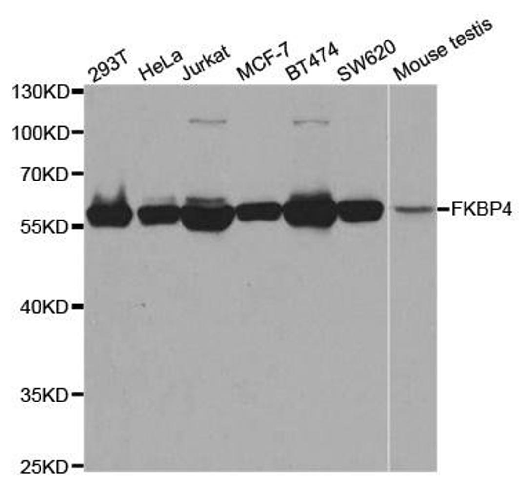 Western blot analysis of extracts of various cell lines using FKBP4 antibody