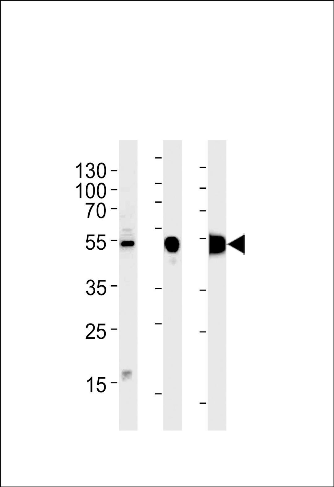 Western blot analysis in RD cell line and mouse skeletal muscle,rat skeletal muscle lysates (35ug/lane).