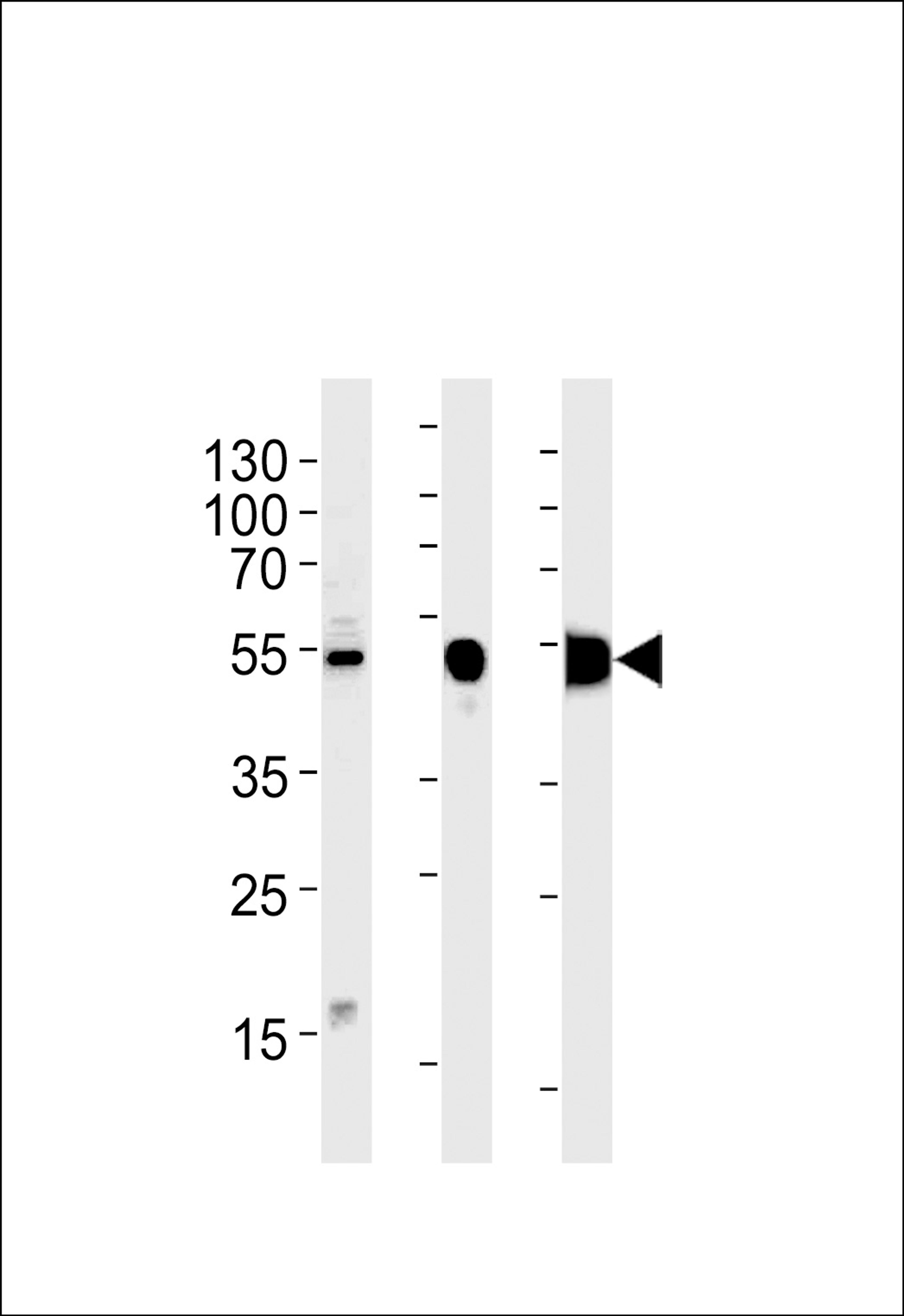 Western blot analysis in RD cell line and mouse skeletal muscle,rat skeletal muscle lysates (35ug/lane).