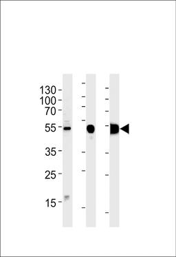 Western blot analysis in RD cell line and mouse skeletal muscle,rat skeletal muscle lysates (35ug/lane).