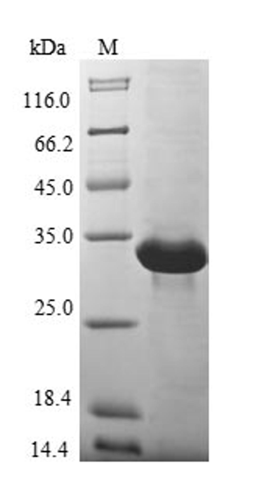 (Tris-Glycine gel) Discontinuous SDS-PAGE (reduced) with 5% enrichment gel and 15% separation gel.