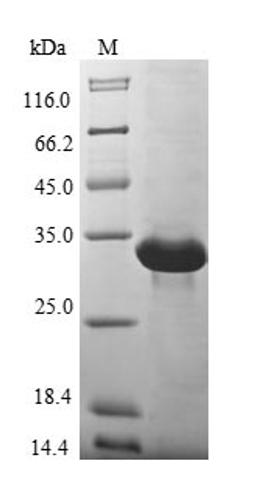 (Tris-Glycine gel) Discontinuous SDS-PAGE (reduced) with 5% enrichment gel and 15% separation gel.
