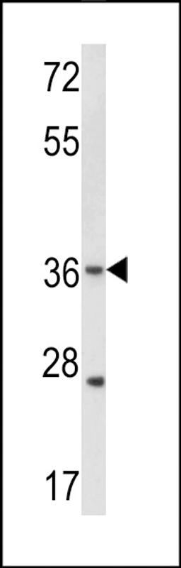 Western blot analysis of hGJB3-C241 in WiDr cell line lysates (35ug/lane)(2ug/ml)