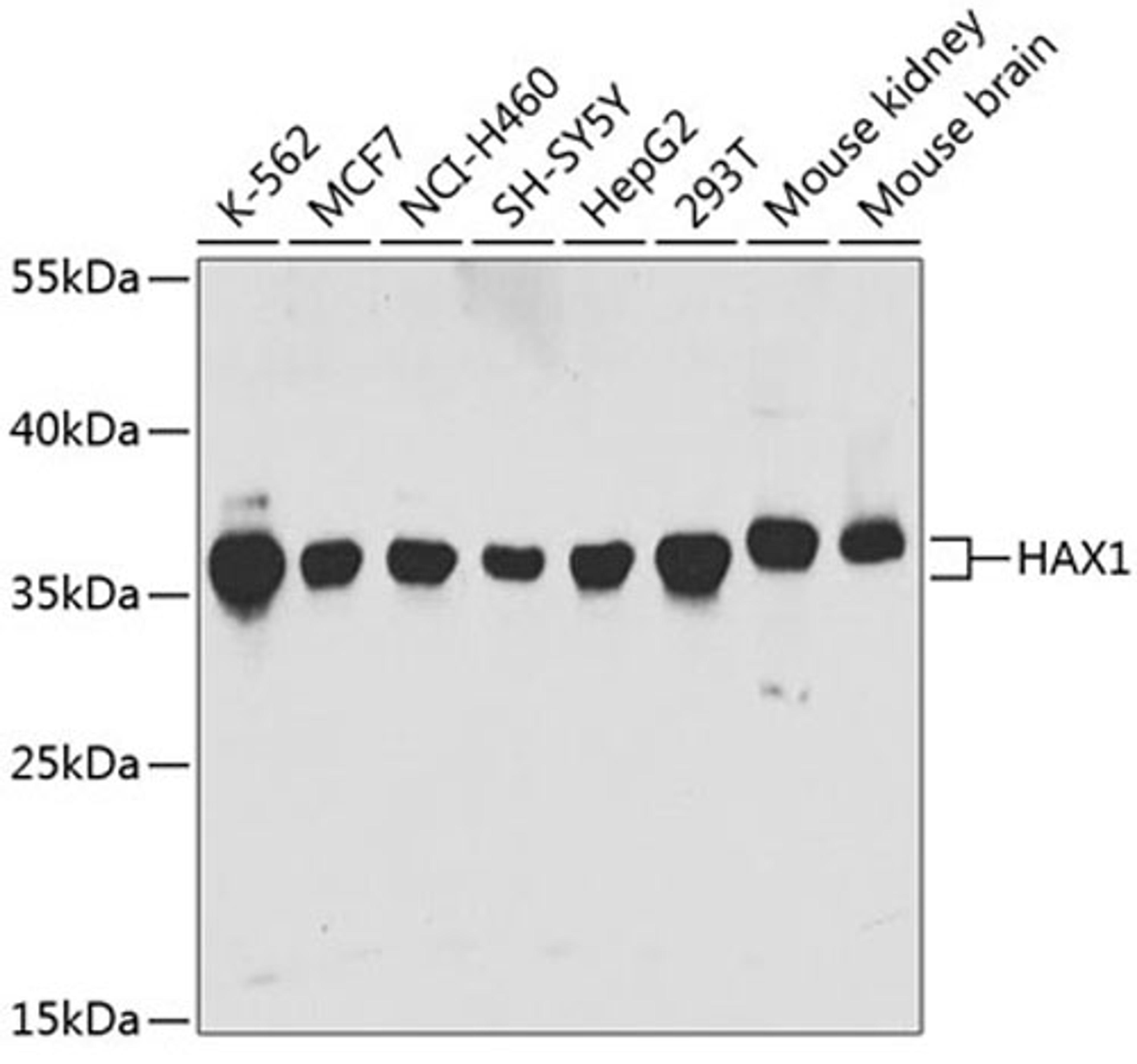 Western blot - HAX1 antibody (A5551)