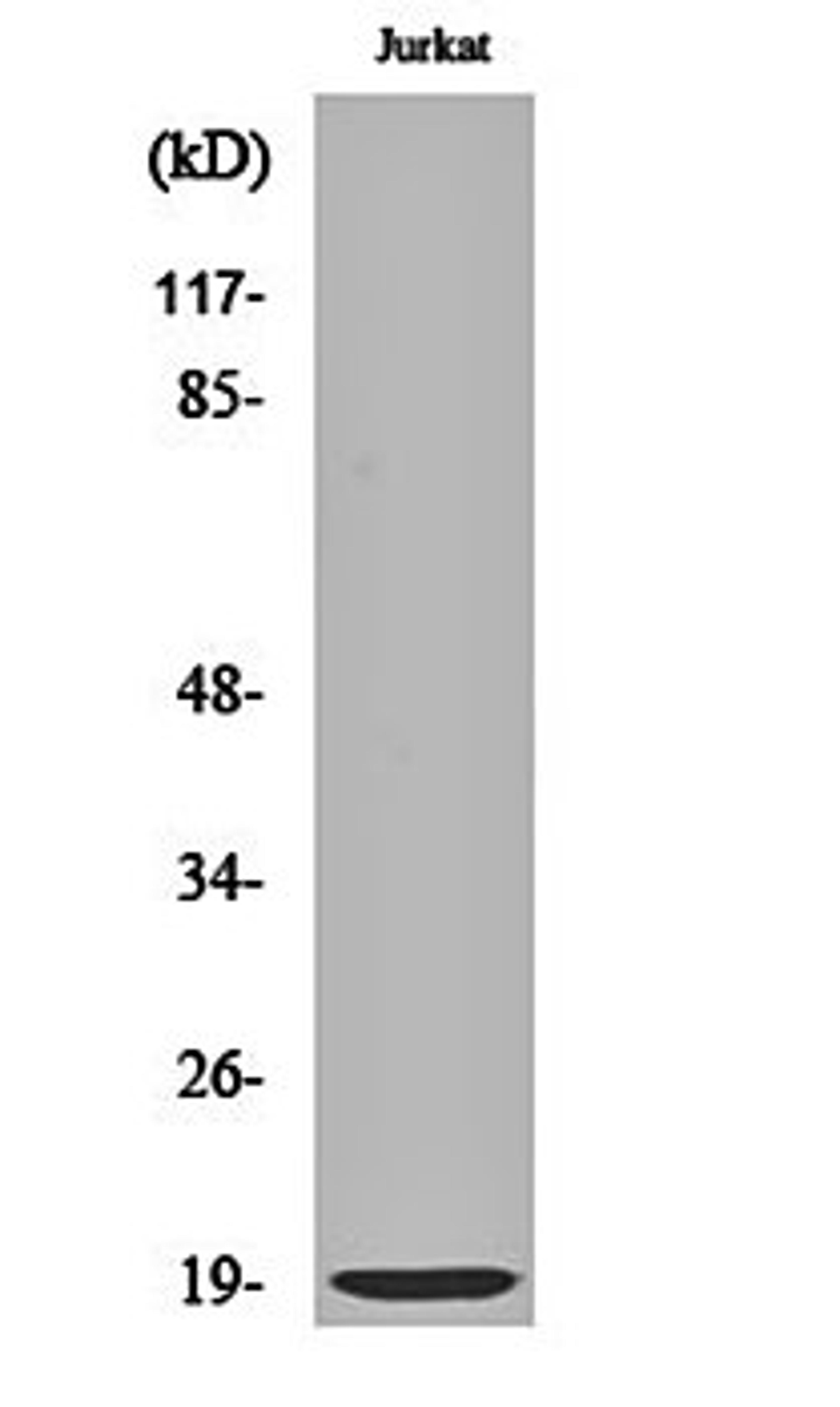 Western blot analysis of Jurkat cell lysates using DAN antibody