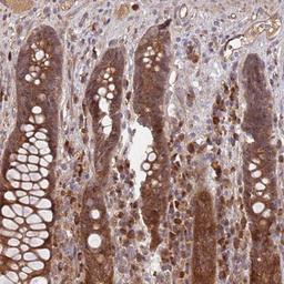 Immunohistochemistry-Paraffin: KANSL1L Antibody [NBP2-14139] - Staining of human rectum shows strong cytoplasmic positivity in glandular cells.