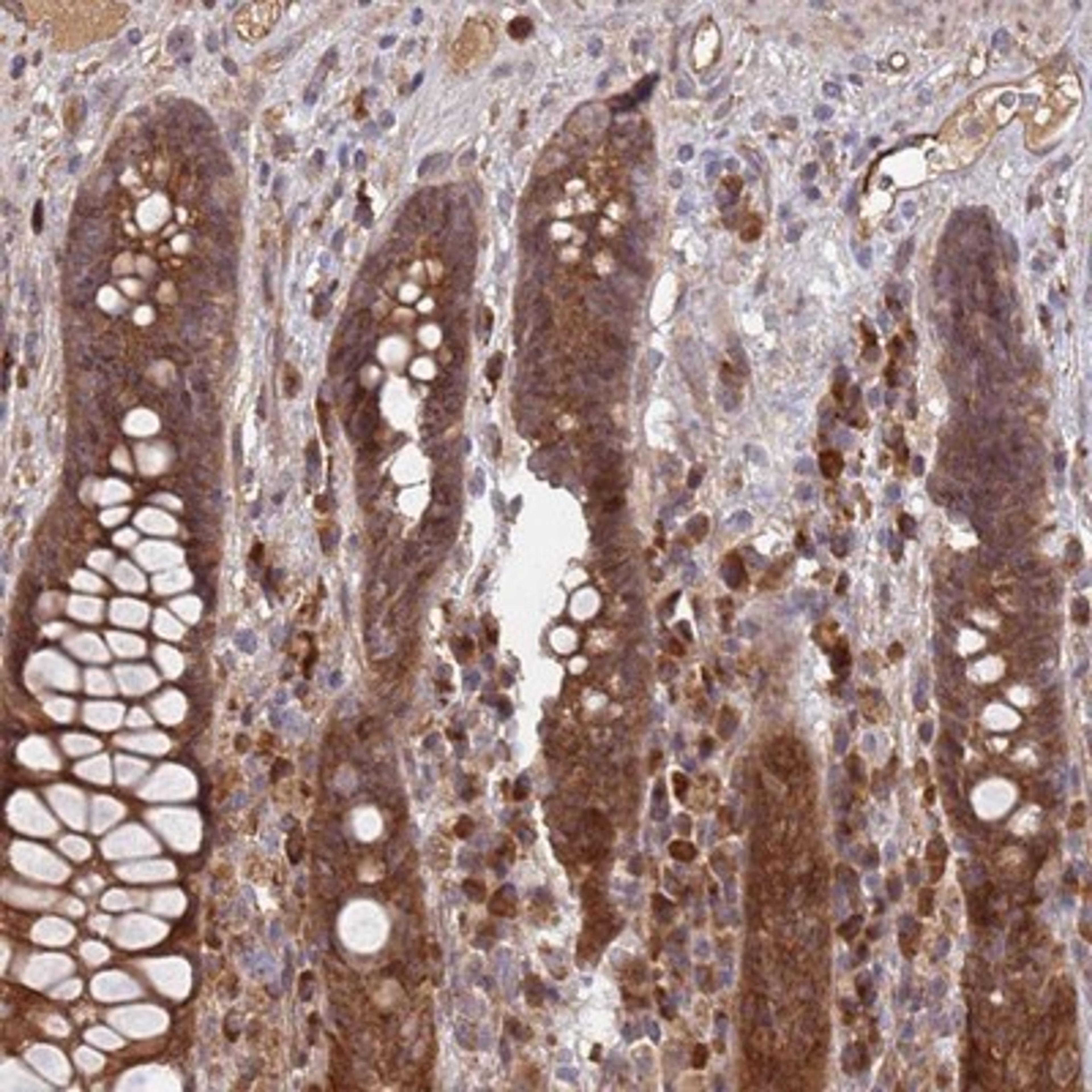 Immunohistochemistry-Paraffin: KANSL1L Antibody [NBP2-14139] - Staining of human rectum shows strong cytoplasmic positivity in glandular cells.