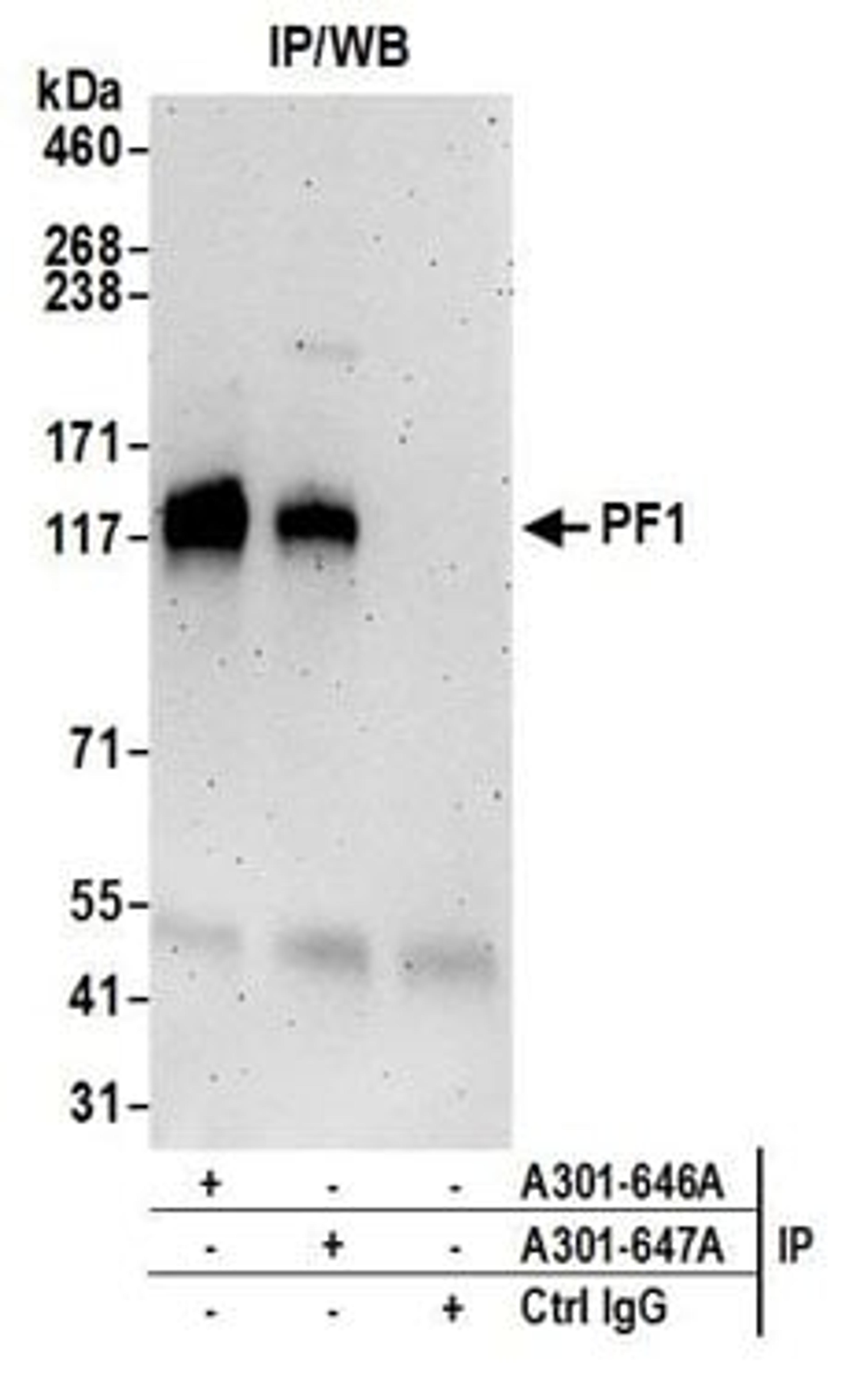 Detection of human PF1 by western blot of immunoprecipitates.