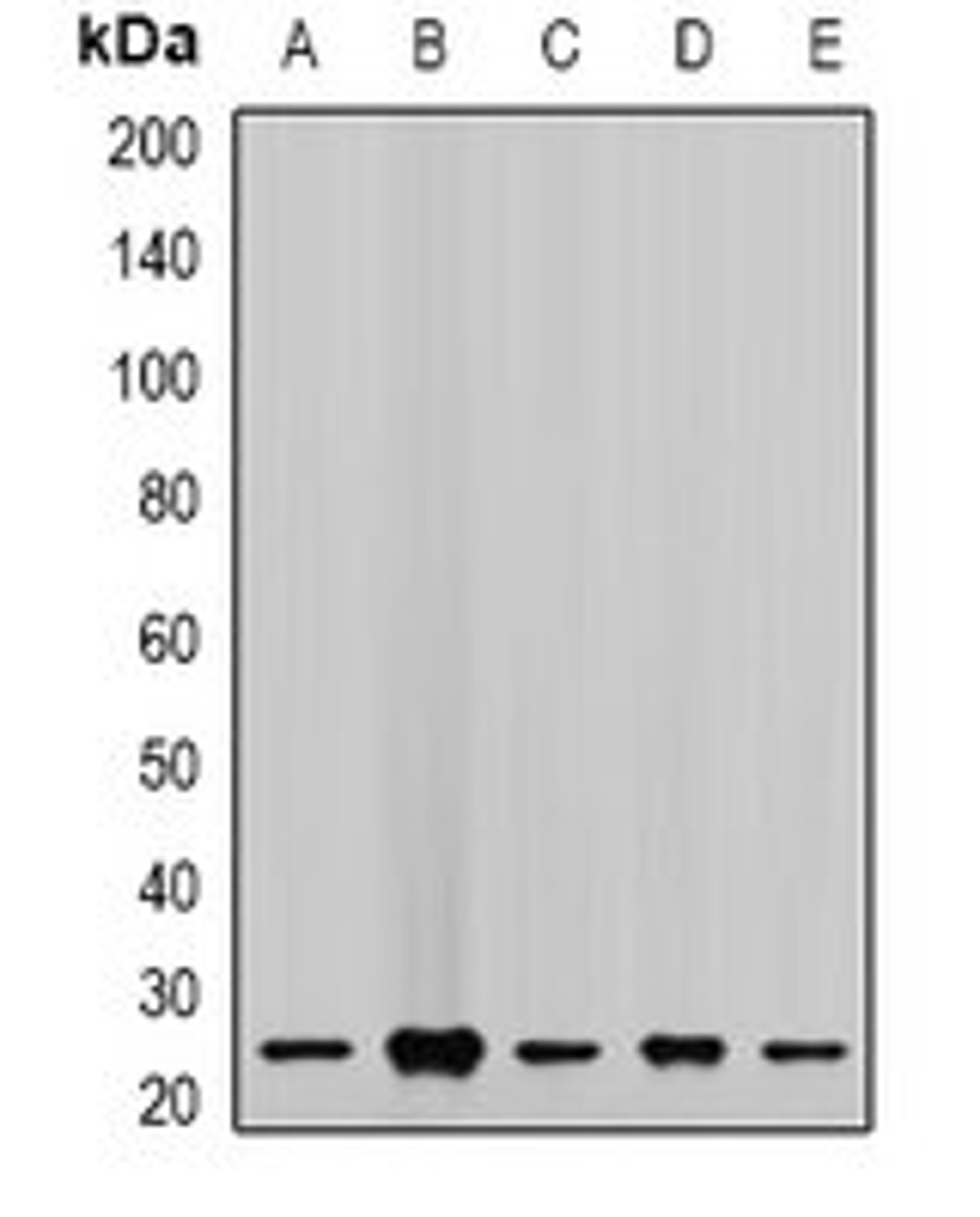 Western blot analysis of MCF7 (Lane1), LOVO (Lane2), A549 (Lane3), mouse lung (Lane4), mouse kidney (Lane5) whole cell lysates using CHMP2B antibody