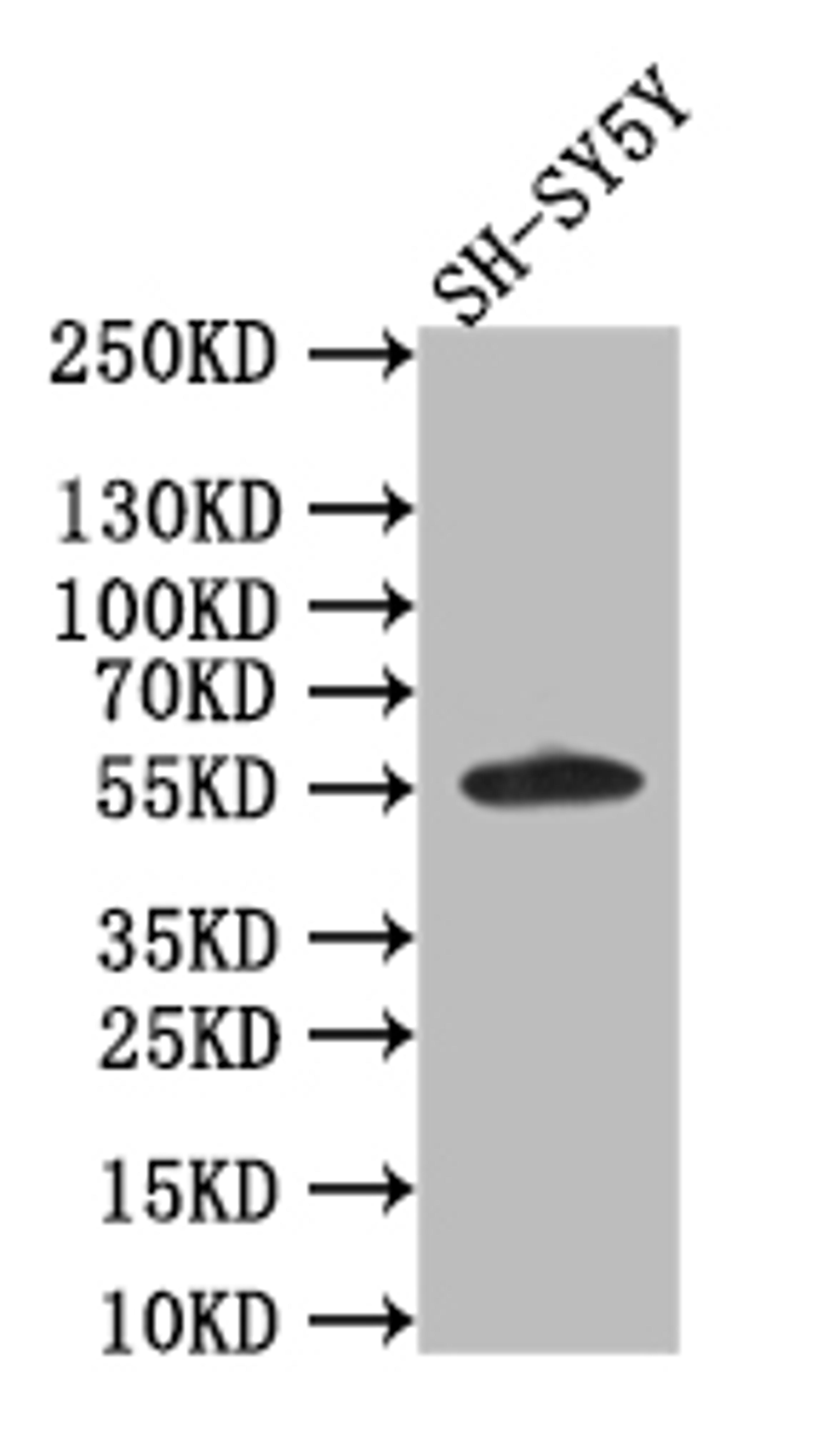Western Blot. Positive WB detected in: SH-SY5Y whole cell lysate. All lanes: CD44 antibody at 1:1000. Secondary. Goat polyclonal to rabbit IgG at 1/50000 dilution. Predicted band size: 56 kDa. Observed band size: 56 kDa. 