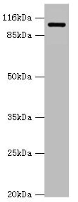Western blot. All lanes: AP2A2 antibody at 0.61ug/ml + Mouse brain tissue. Secondary. Goat polyclonal to rabbit IgG at 1/10000 dilution. Predicted band size: 104, 105, 74 kDa. Observed band size: 104 kDa. 