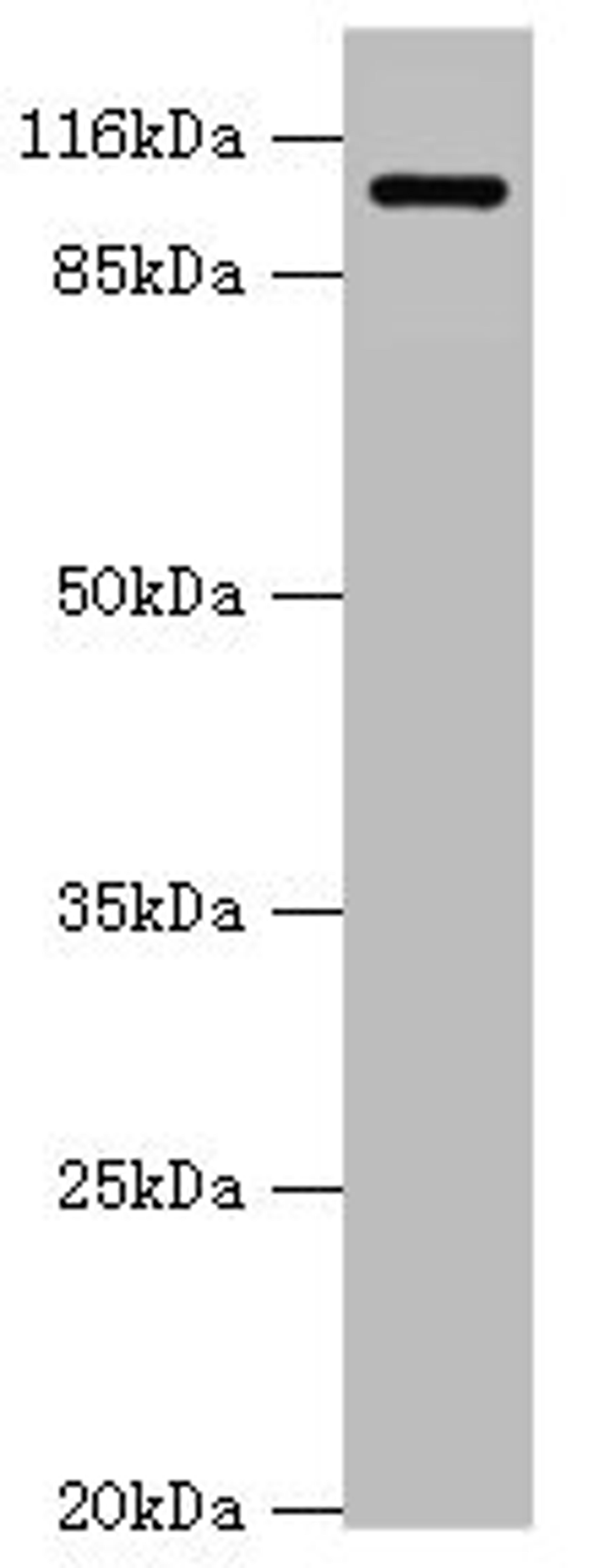 Western blot. All lanes: AP2A2 antibody at 0.61ug/ml + Mouse brain tissue. Secondary. Goat polyclonal to rabbit IgG at 1/10000 dilution. Predicted band size: 104, 105, 74 kDa. Observed band size: 104 kDa. 