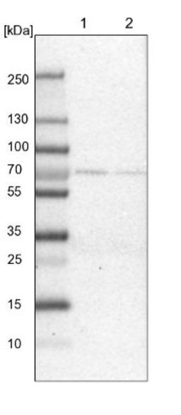 Western Blot: SRP68 Antibody [NBP1-89532] - Lane 1: NIH-3T3 cell lysate (Mouse embryonic fibroblast cells)<br/>Lane 2: NBT-II cell lysate (Rat Wistar bladder tumour cells)