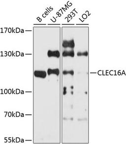 Western blot - CLEC16A antibody (A9753)