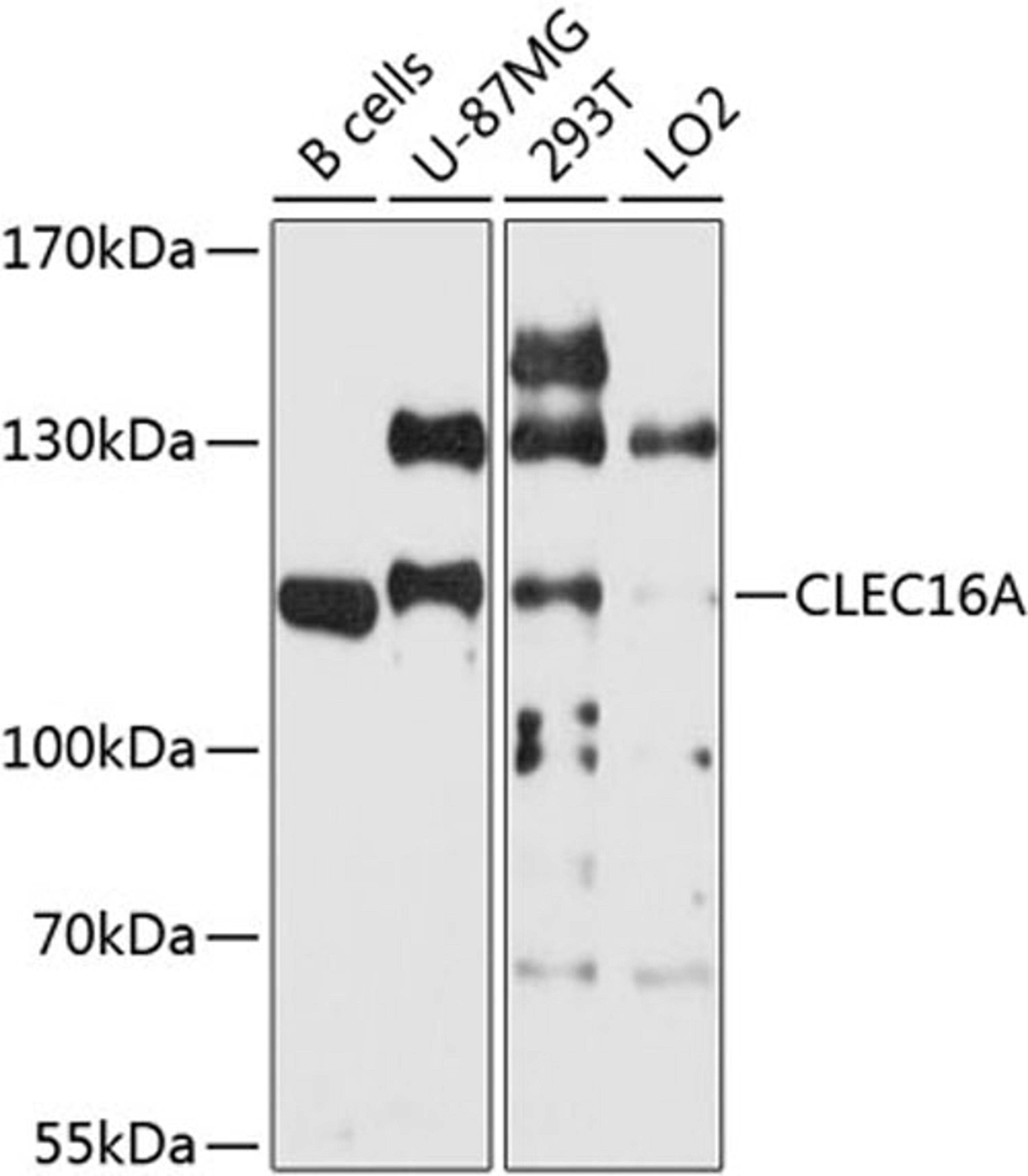 Western blot - CLEC16A antibody (A9753)