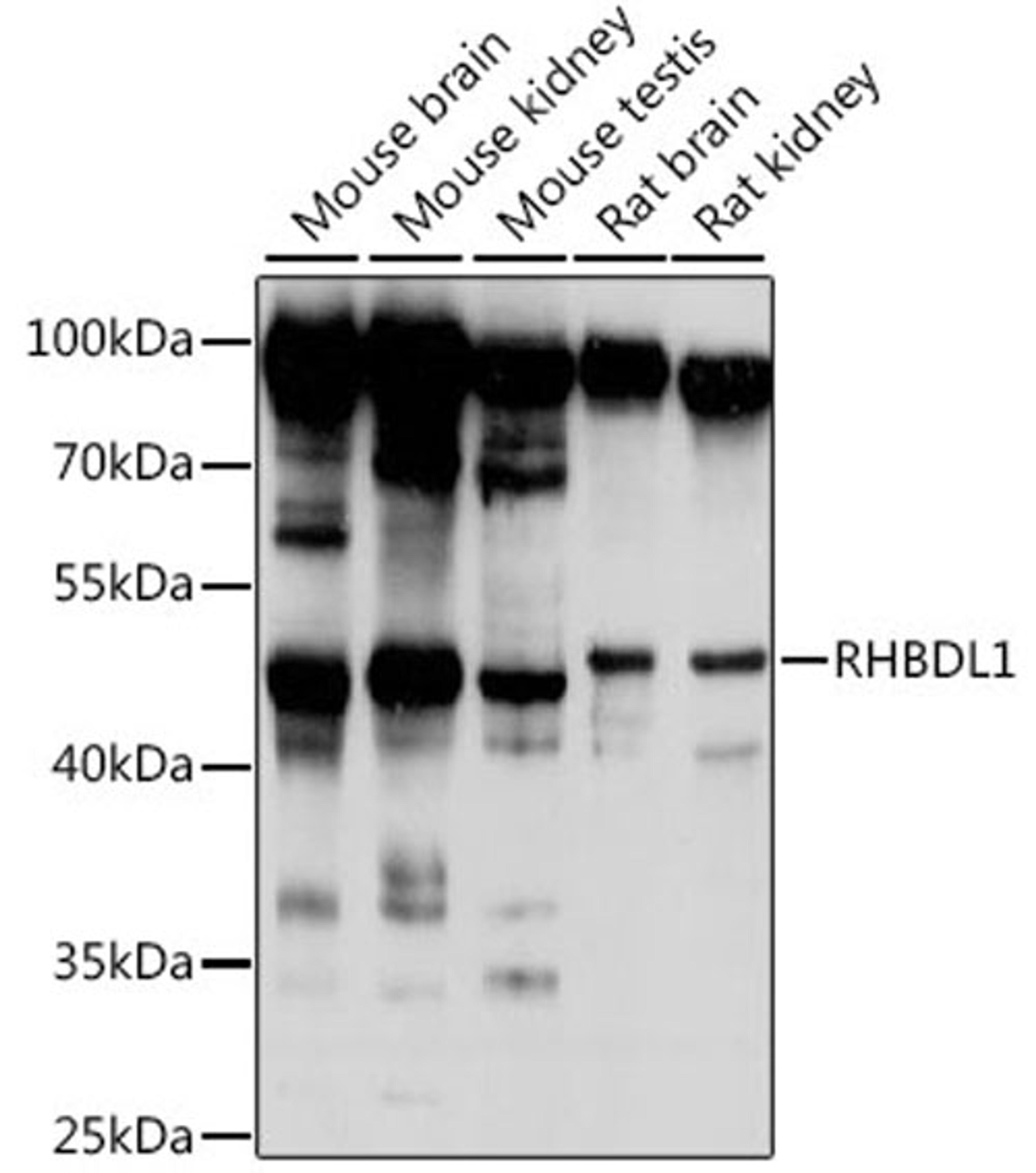 Western blot - RHBDL1 antibody (A16084)