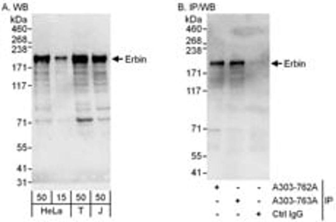 Detection of human Erbin by western blot and immunoprecipitation.