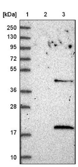 Western Blot: LSM4 Antibody [NBP1-86846] - Lane 1: Marker [kDa] 250, 130, 95, 72, 55, 36, 28, 17, 10<br/>Lane 2: Negative control (vector only transfected HEK293T lysate)<br/>Lane 3: Over-expression lysate (Co-expressed with a C-terminal myc-DDK tag (~3.1 kDa) in mammalian HEK293T cells, LY402199)