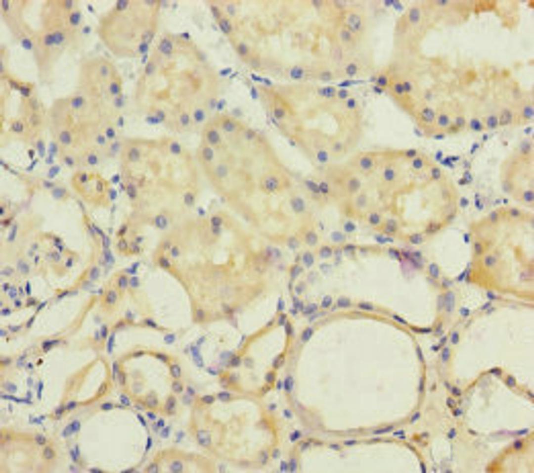 Immunohistochemistry of paraffin-embedded human kidney tissue using CSB-PA896481ESR2HU at dilution of 1:100