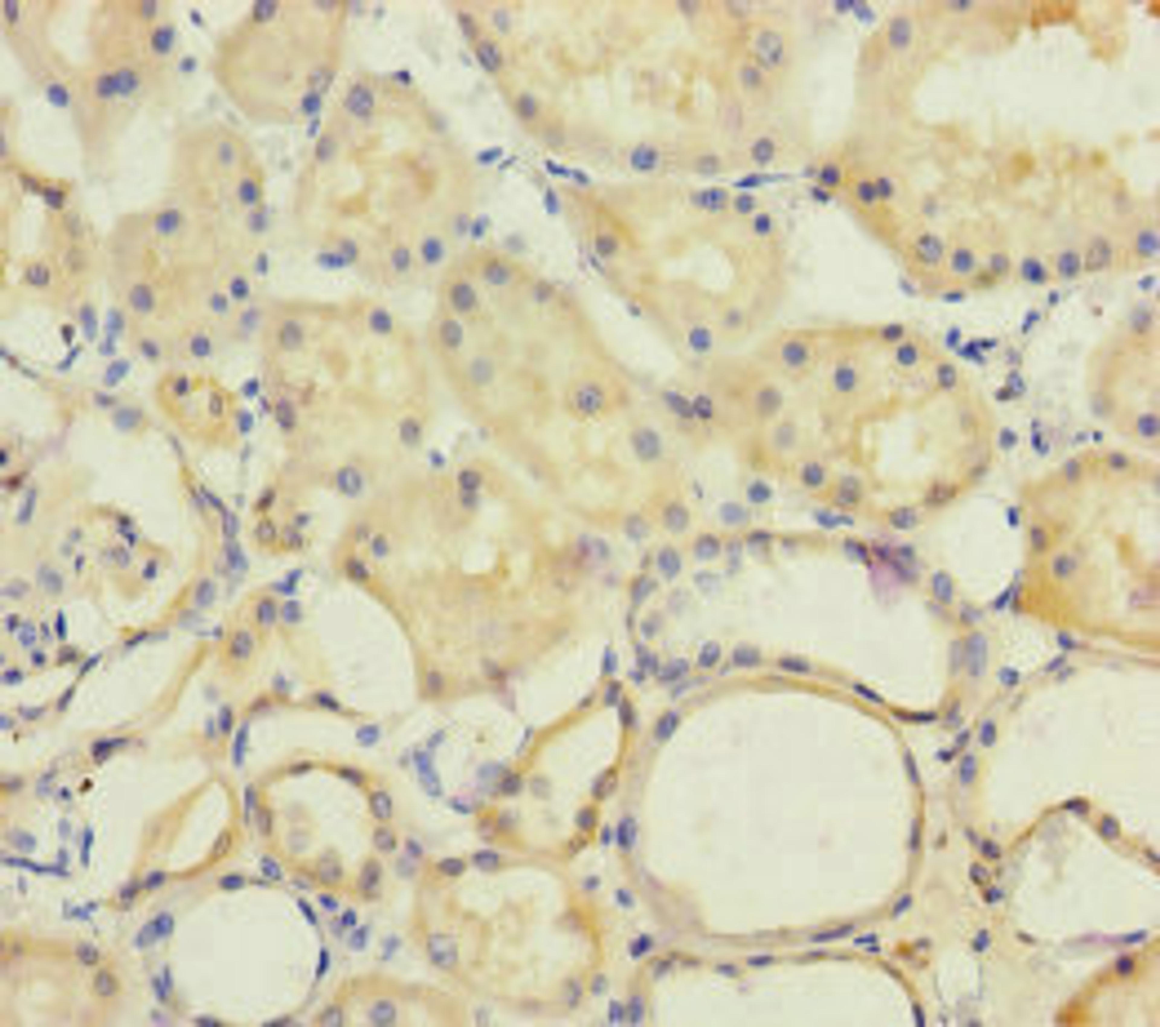 Immunohistochemistry of paraffin-embedded human kidney tissue using CSB-PA896481ESR2HU at dilution of 1:100