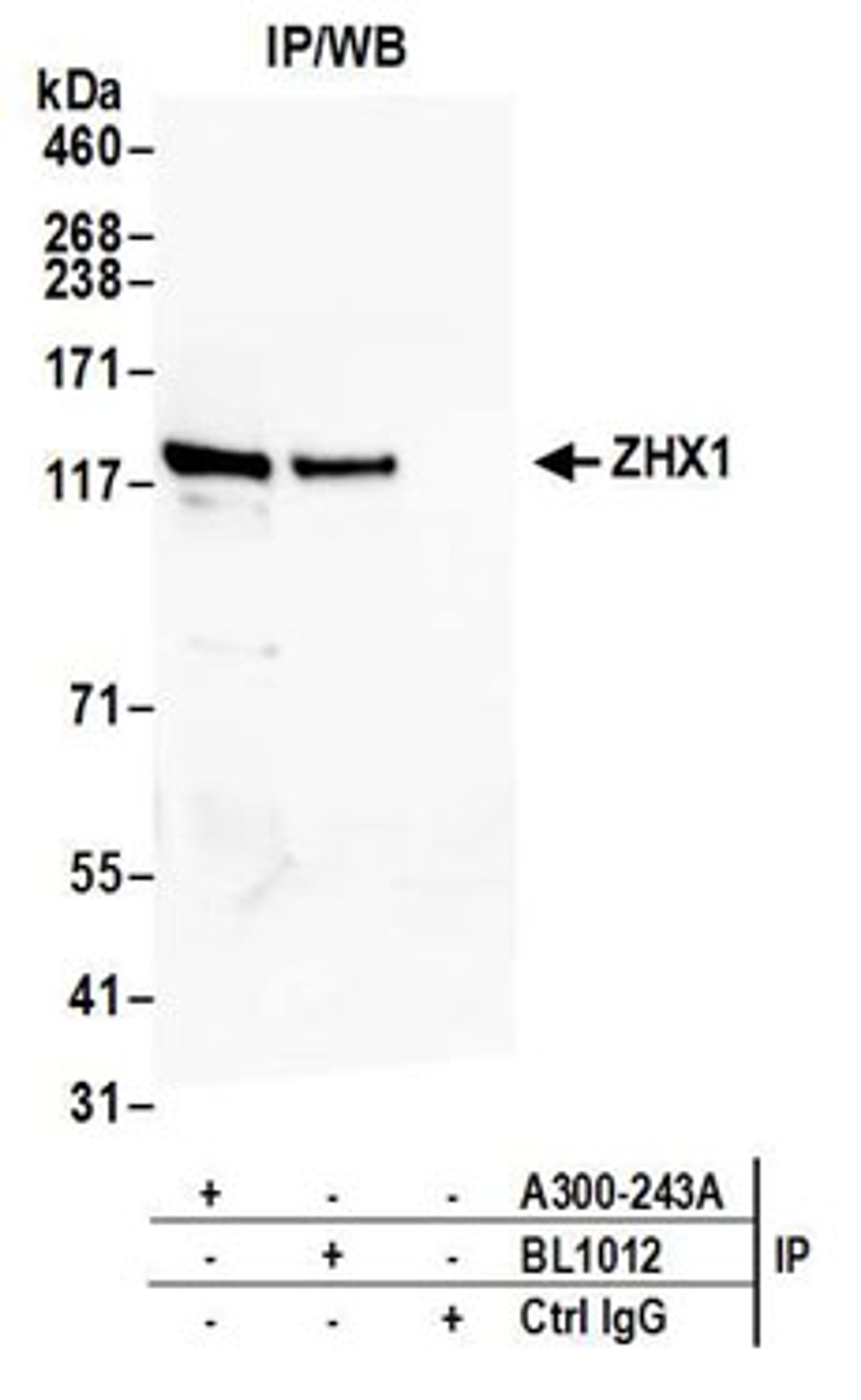 Detection of human ZHX1 by western blot of immunoprecipitates.