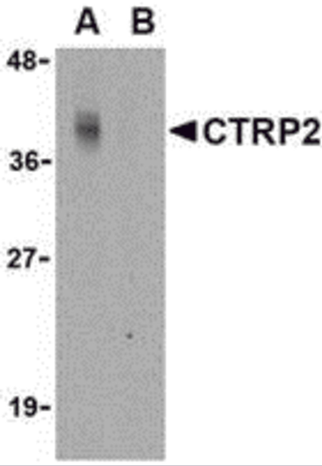 Western blot analysis of CTRP2 in Caco-2 cell lysate with CTRP2 antibody at 1 &#956;g/mL in either the (A) absence or (B) presence of blocking peptide.