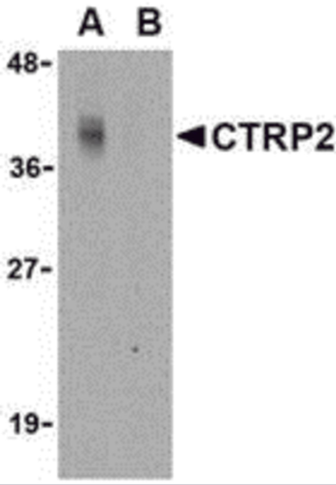 Western blot analysis of CTRP2 in Caco-2 cell lysate with CTRP2 antibody at 1 μg/mL in either the (A) absence or (B) presence of blocking peptide.