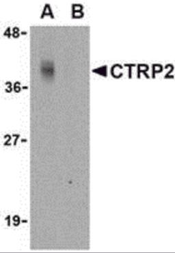 Western blot analysis of CTRP2 in Caco-2 cell lysate with CTRP2 antibody at 1 μg/mL in either the (A) absence or (B) presence of blocking peptide.