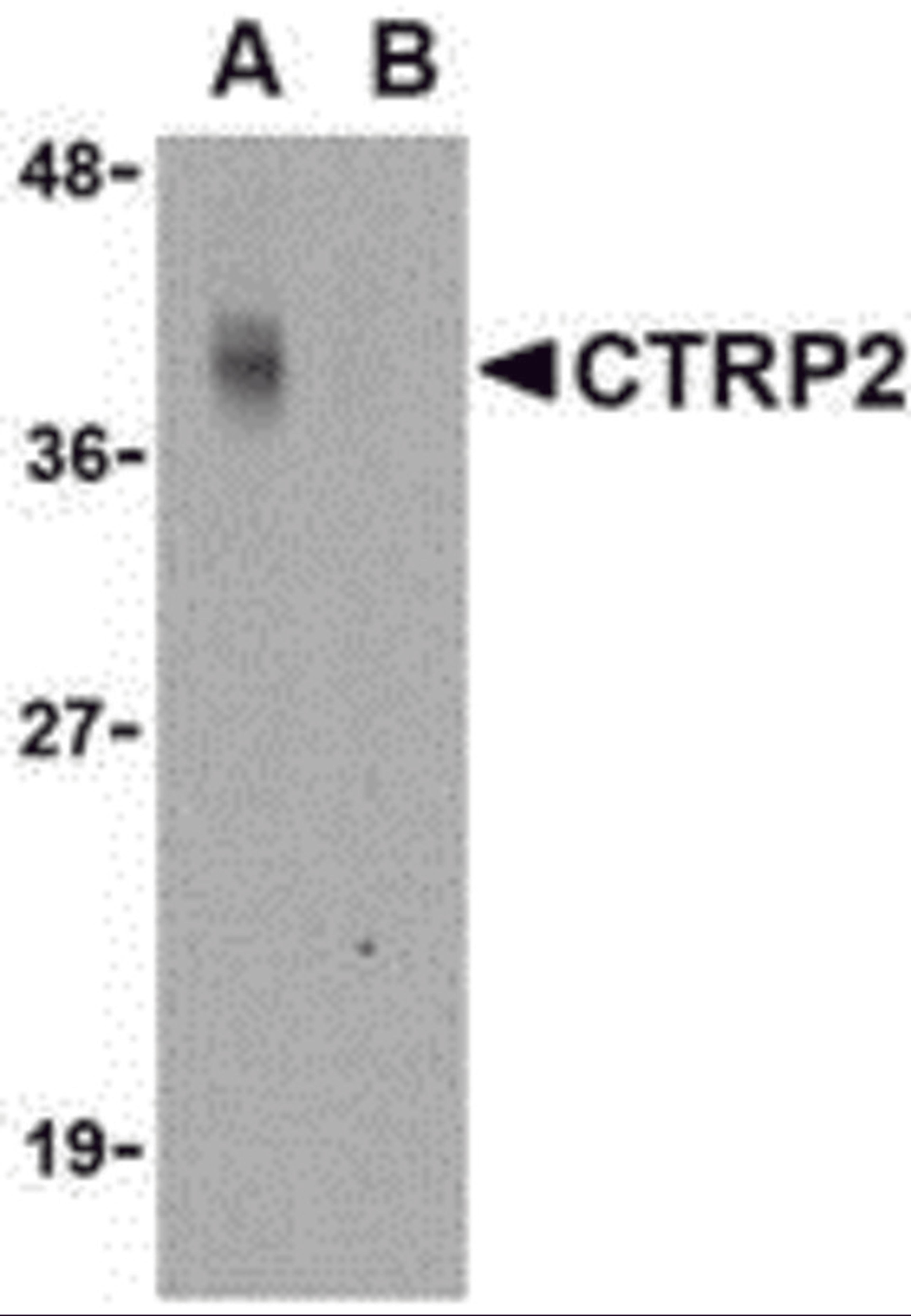 Western blot analysis of CTRP2 in Caco-2 cell lysate with CTRP2 antibody at 1 μg/mL in either the (A) absence or (B) presence of blocking peptide.