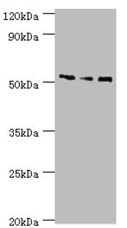 Western blot. All lanes: Neuronal acetylcholine receptor subunit alpha-5 antibody at 12ug/ml. Lane 1: Jurkat whole cell lysate. Lane 2: A431 whole cell lysate. Lane 3: A549 whole cell lysate. Secondary. Goat polyclonal to rabbit IgG at 1/10000 dilution. Predicted band size: 53 kDa. Observed band size: 53 kDa. 