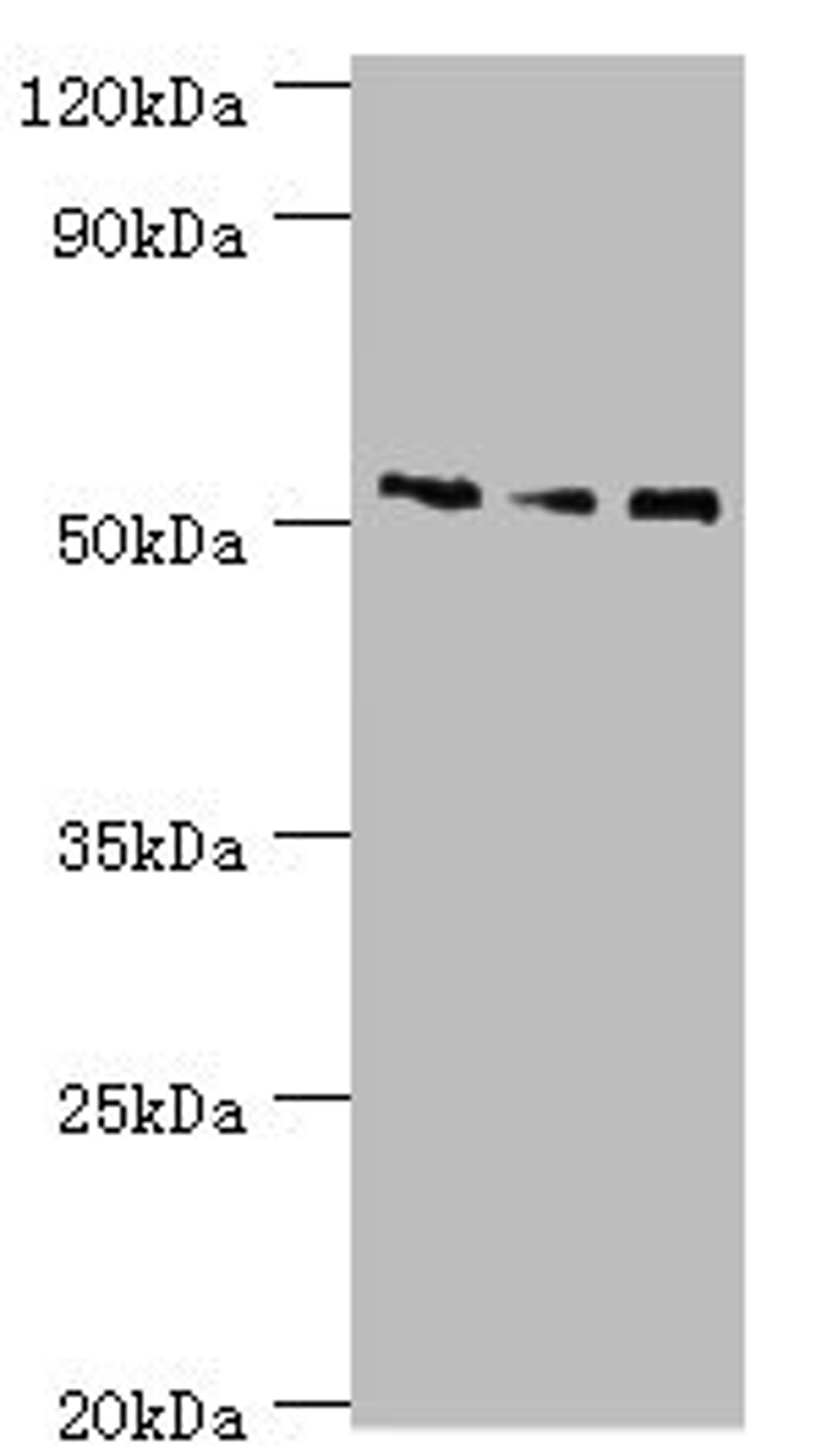 Western blot. All lanes: Neuronal acetylcholine receptor subunit alpha-5 antibody at 12ug/ml. Lane 1: Jurkat whole cell lysate. Lane 2: A431 whole cell lysate. Lane 3: A549 whole cell lysate. Secondary. Goat polyclonal to rabbit IgG at 1/10000 dilution. Predicted band size: 53 kDa. Observed band size: 53 kDa. 