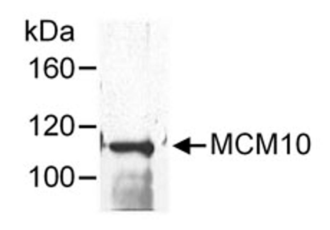 Detection of human MCM10 by western blot following immunoprecipitation.