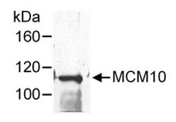 Detection of human MCM10 by western blot following immunoprecipitation.