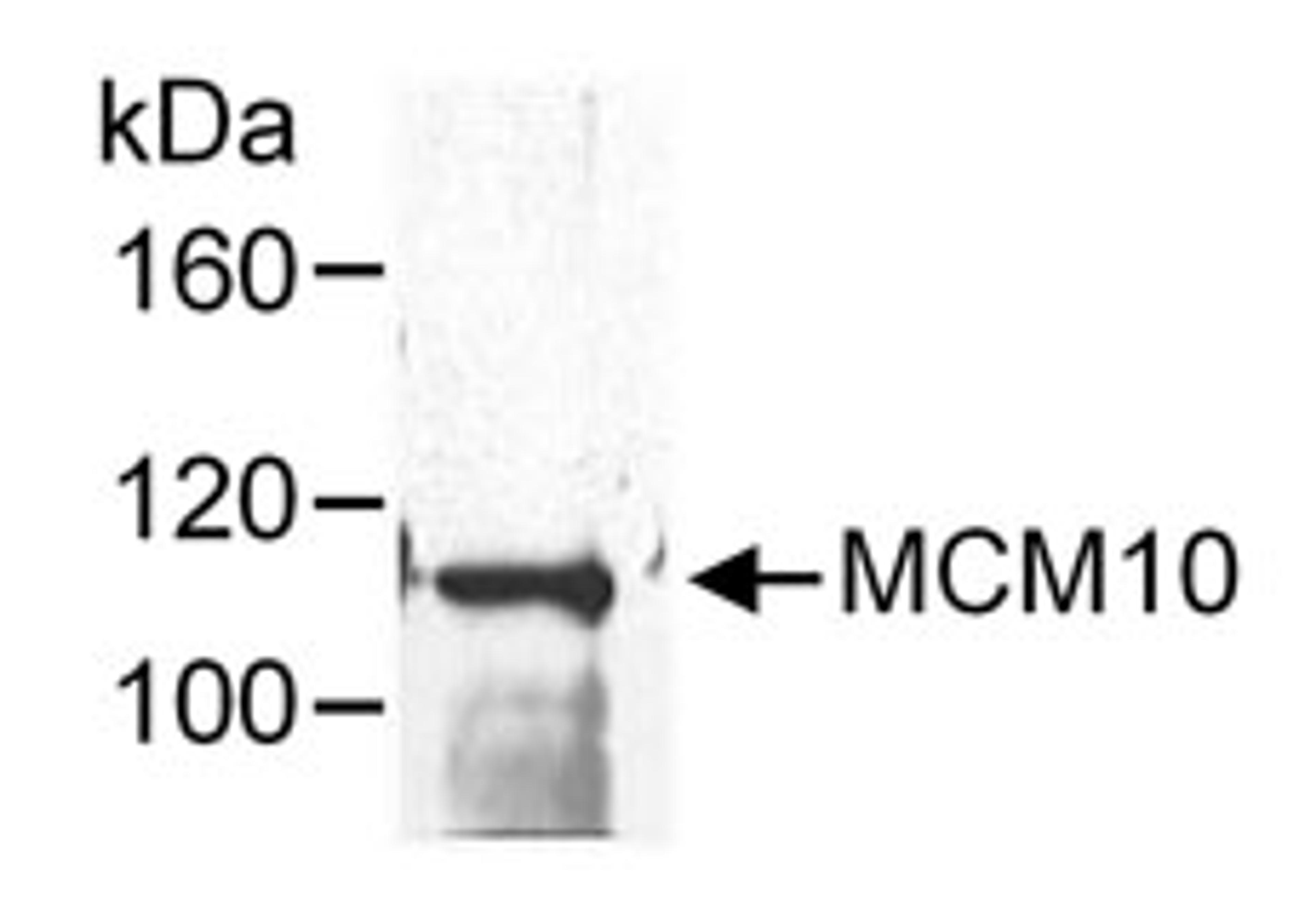 Detection of human MCM10 by western blot following immunoprecipitation.