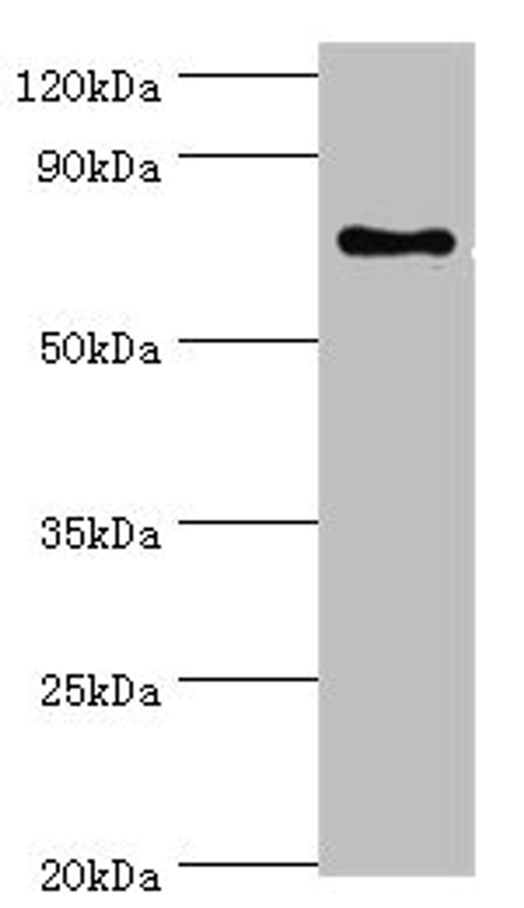 Western blot. All lanes: SLC27A6 antibody at 4ug/ml + MCF-7 whole cell lysate. Secondary. Goat polyclonal to rabbit IgG at 1/10000 dilution. Predicted band size: 70 kDa. Observed band size: 70 kDa. 