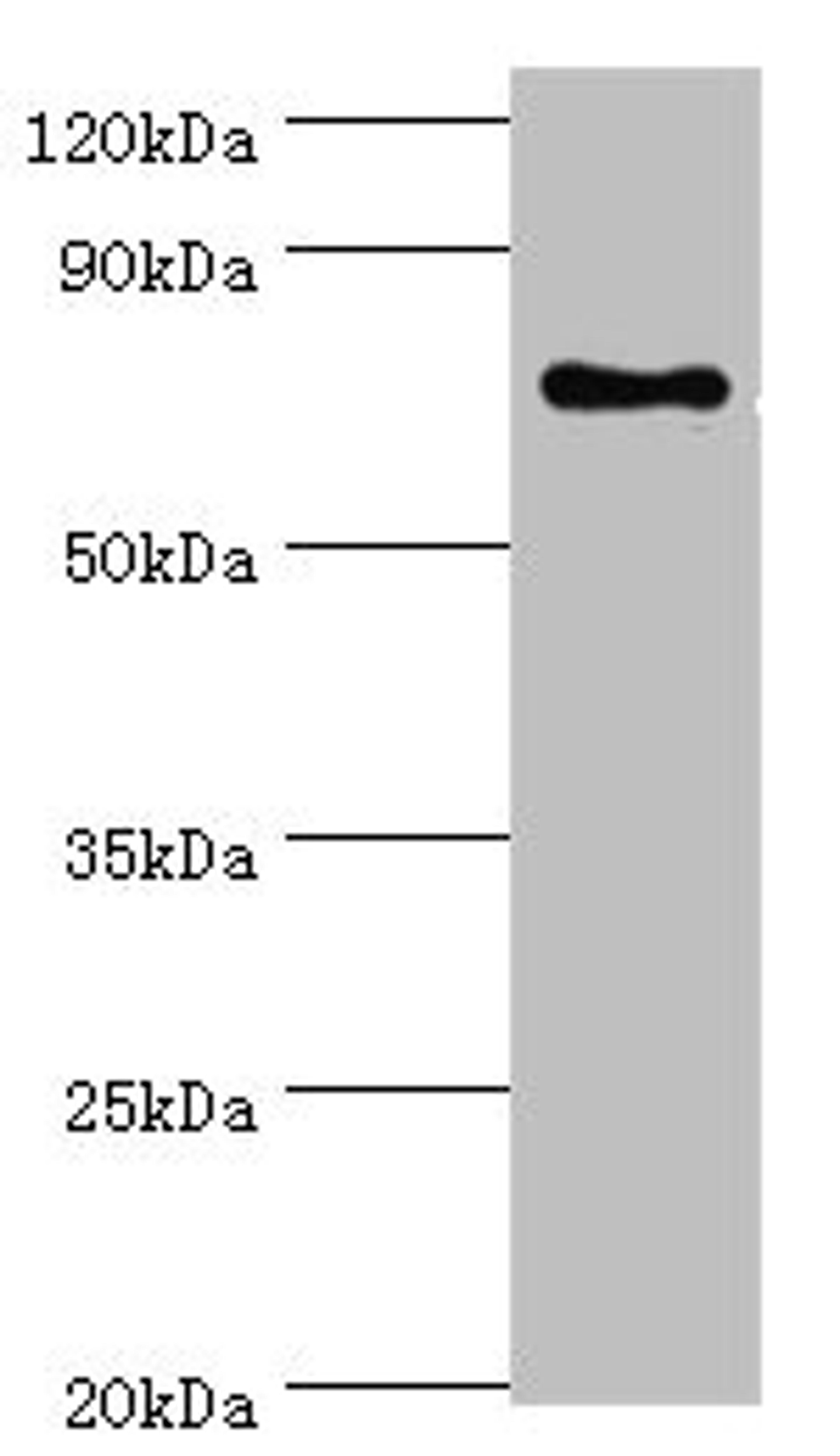 Western blot. All lanes: SLC27A6 antibody at 4ug/ml + MCF-7 whole cell lysate. Secondary. Goat polyclonal to rabbit IgG at 1/10000 dilution. Predicted band size: 70 kDa. Observed band size: 70 kDa. 