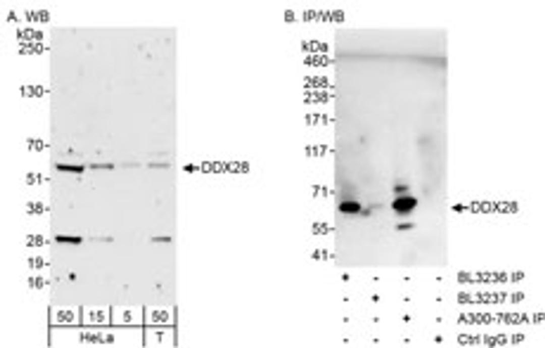 Detection of human DDX28 by western blot and immunoprecipitation.