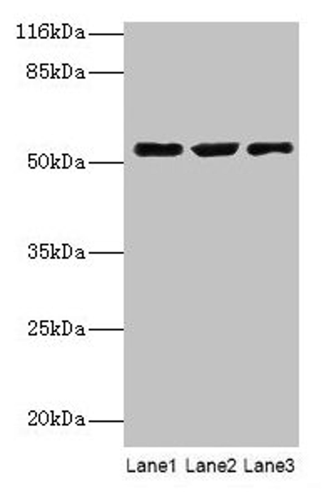 Western blot. All lanes: CRNN antibody at 12µg/ml. Lane 1: HepG2 whole cell lysate. Lane 2: Mouse heart tissue. Lane 3: Rat skeletal muscle tissue. Secondary. Goat polyclonal to rabbit IgG at 1/10000 dilution. Predicted band size: 54 kDa. Observed band size: 54 kDa