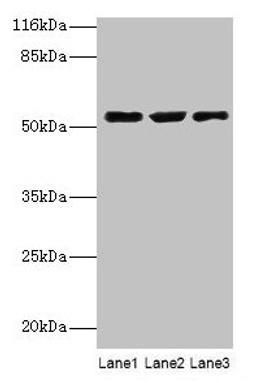 Western blot. All lanes: CRNN antibody at 12µg/ml. Lane 1: HepG2 whole cell lysate. Lane 2: Mouse heart tissue. Lane 3: Rat skeletal muscle tissue. Secondary. Goat polyclonal to rabbit IgG at 1/10000 dilution. Predicted band size: 54 kDa. Observed band size: 54 kDa