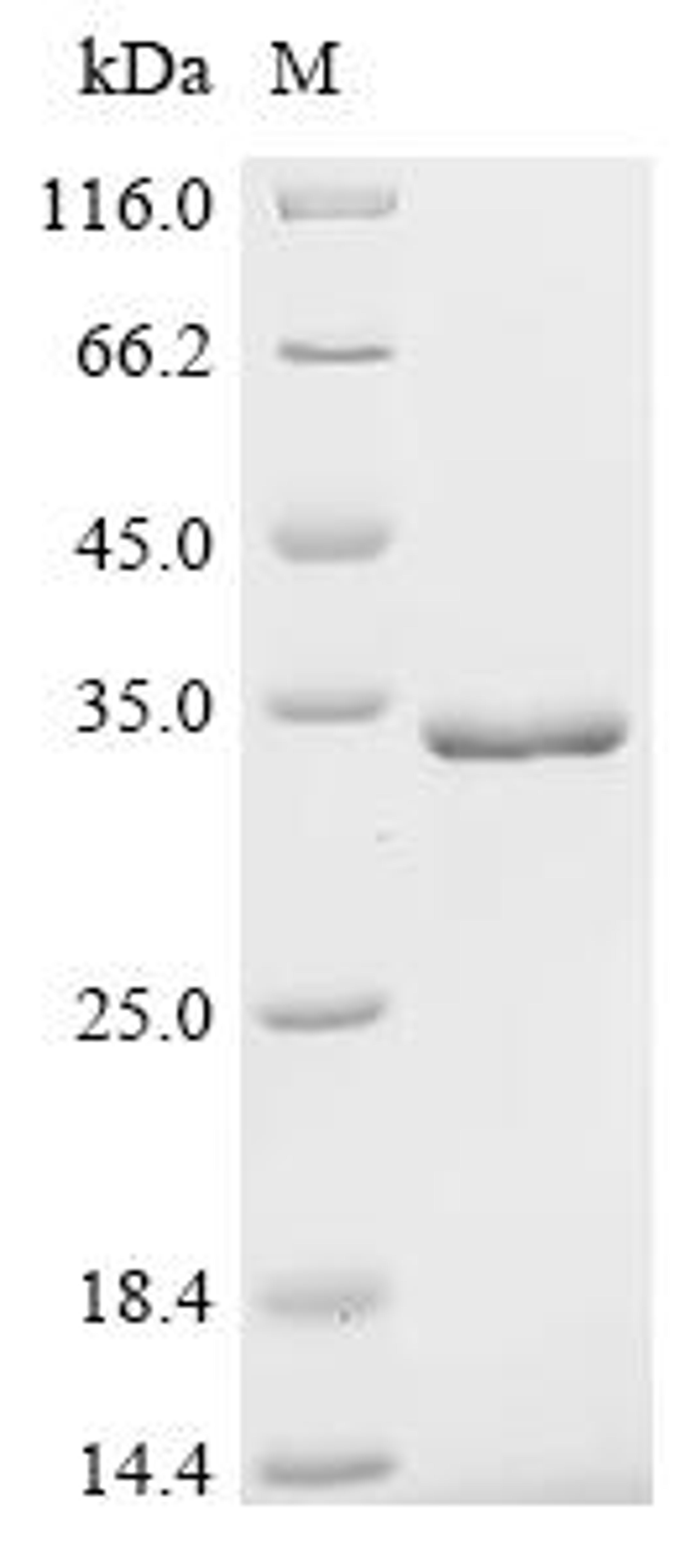 (Tris-Glycine gel) Discontinuous SDS-PAGE (reduced) with 5% enrichment gel and 15% separation gel.