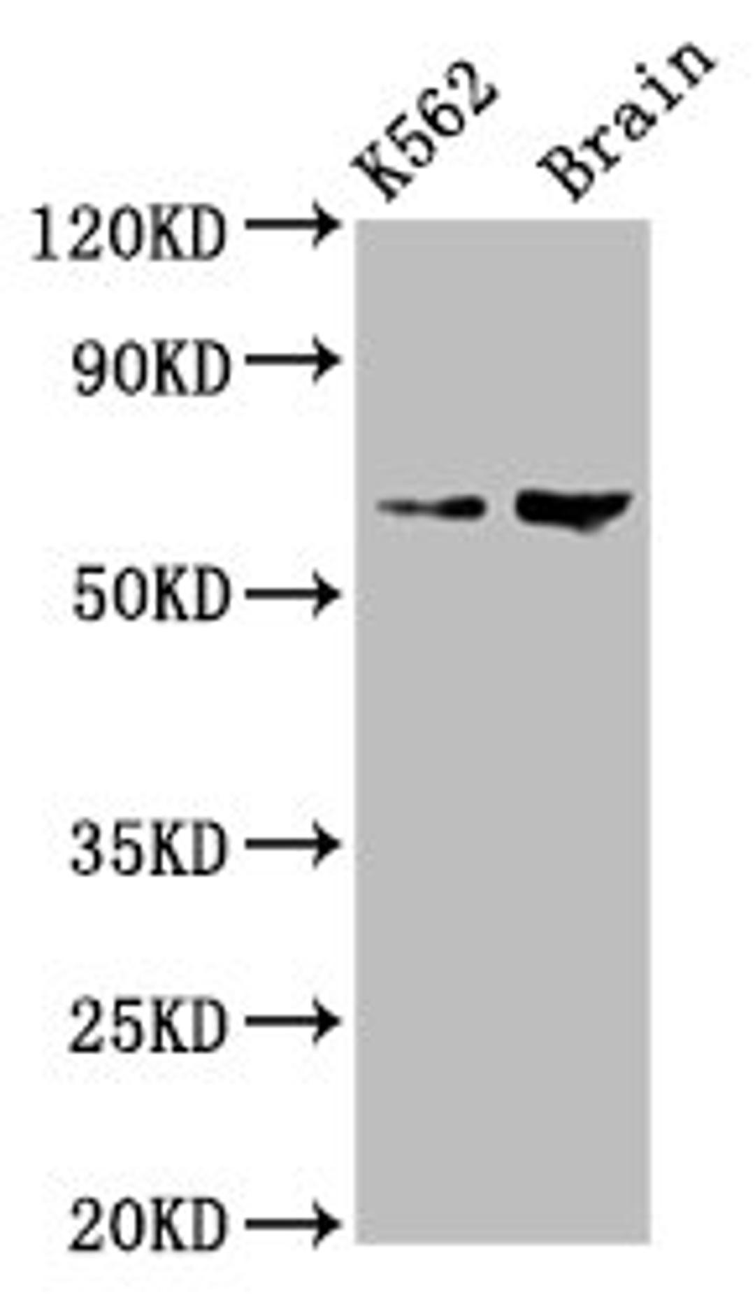 Western Blot. Positive WB detected in: K562 whole cell lysate, Rat brain tissue. All lanes: BRAP antibody at 7.5µg/ml. Secondary. Goat polyclonal to rabbit IgG at 1/50000 dilution. Predicted band size: 68, 48 kDa. Observed band size: 68 kDa