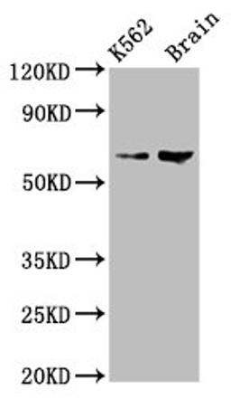 Western Blot. Positive WB detected in: K562 whole cell lysate, Rat brain tissue. All lanes: BRAP antibody at 7.5µg/ml. Secondary. Goat polyclonal to rabbit IgG at 1/50000 dilution. Predicted band size: 68, 48 kDa. Observed band size: 68 kDa